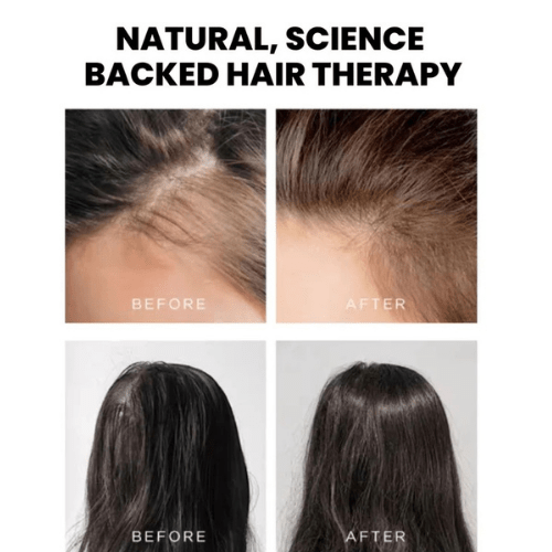 Led Light Therapy Hair Brush