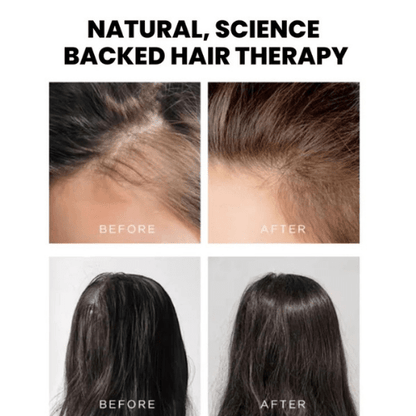 Led Light Therapy Hair Brush